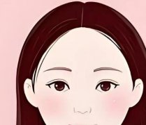 开眼角1个月恢复过程图怎么样？真实案例过程分享，医美党必收藏