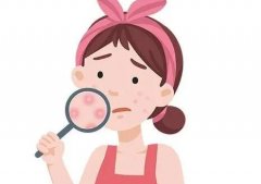 怎样除青春痘？过来人亲测有效方法分享