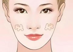 深圳悦她医疗美容怎么样？医院核心优势、热门项目盘点