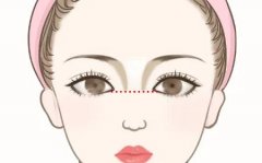 广州可玉做鼻子怎么样？亲测妈生鼻全过程，优缺点全坦白不藏私