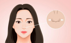 北京米扬丽格做鼻子怎么样？自然系还是精致系，先看这份参考