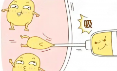 广州华美吸脂吸脂张思华主任怎么样？技术特点、擅长部位、术后反馈详解