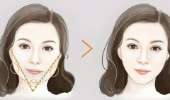 广州广大整形医院磨骨怎么样？从资质门槛到医生经验，再到术后口碑，这些都要看