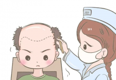 碧莲盛发际线调整怎么样？流程、价格、恢复期和自然度一次说透