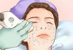深圳阳光整形医院光子嫩肤多少钱?真实价目表+项目科普+注意事项都在这了